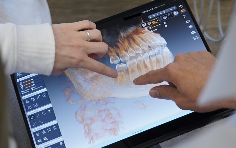 Neues 3D Röntgengerät