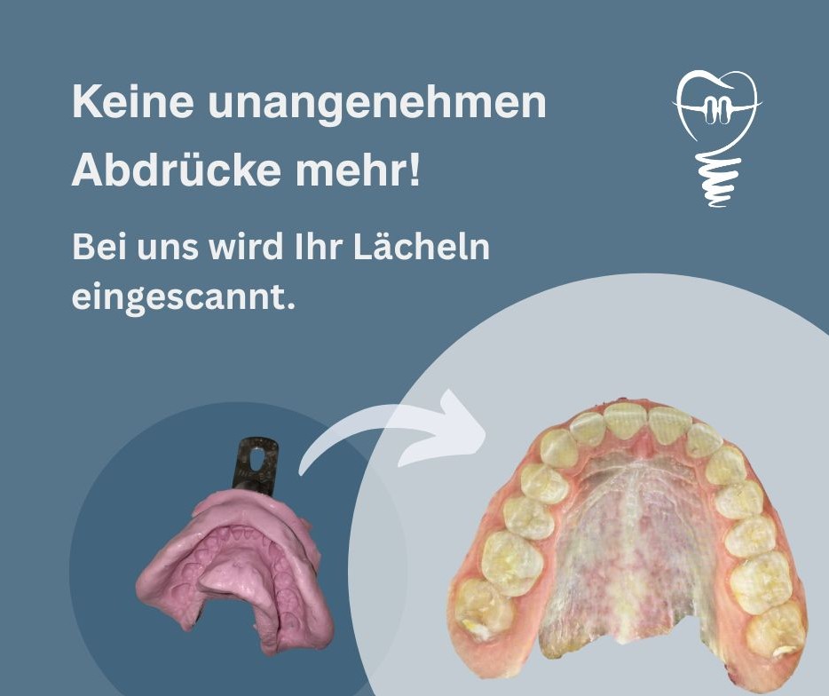 Keine unangenehmen Abdrücke mehr