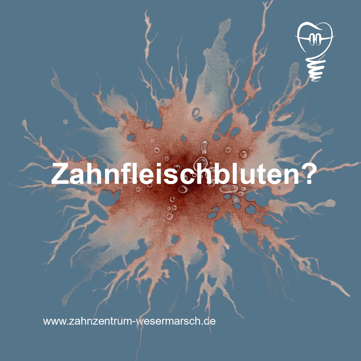 Zahnfleischbluten?